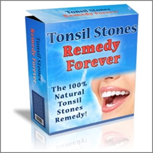 Tonsil Stones Remedy Forever